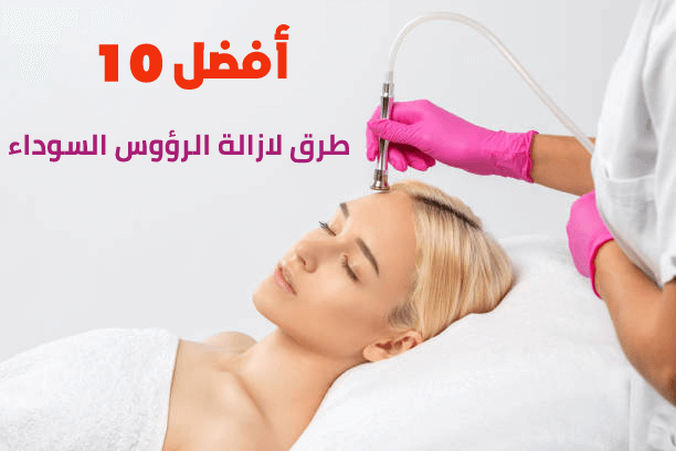 أفضل 10 طرق فعالة للتخلص من الرؤوس السوداء بسهولة